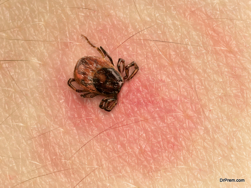 Understand the Great Imitator Known as Lyme Disease